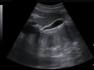 C59 Portable High-End <span class=keywords><strong>Echo</strong></span> untuk Kardiologi <span class=keywords><strong>2D</strong></span> 3D 4D Color <span class=keywords><strong>Doppler</strong></span> Veteriner & Manusia Portable Ultraosund untuk Pemeriksaan Jantung - Product Image 4