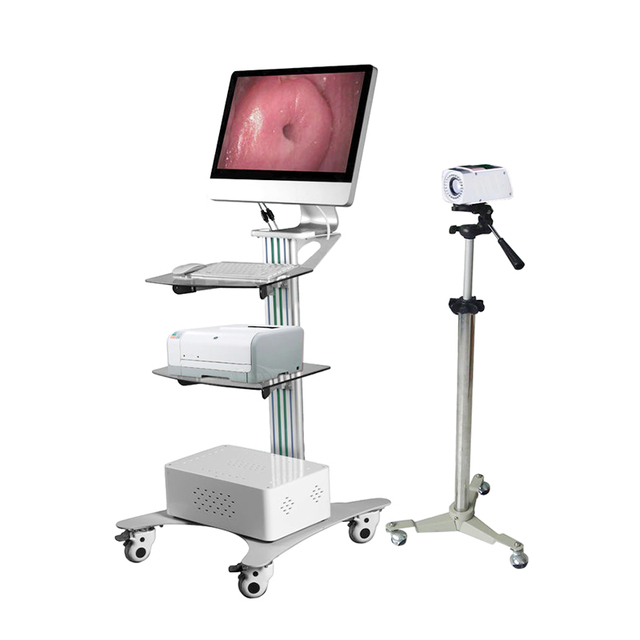 New Design Medical Portable Digital Colposcope Set Vaginal Camera Video Endoscope Gynecological Examination Equipment