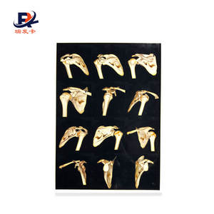 China Kenid Agfa Fuji Digunakan Dalam Pembuatan Film Thermal Medis Kering Printer Medis X-Ray Film - Product Image 2