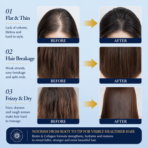 Shampooing <span class=keywords><strong>Bio</strong></span> Anti-Pelliculaire Épaississant <span class=keywords><strong>et</strong></span> Volumisant à la Biotine <span class=keywords><strong>et</strong></span> au Collagène, Fortifiant, Anti-Chute, Nourrissant <span class=keywords><strong>et</strong></span> Réparateur pour <span class=keywords><strong>Cheveux</strong></span> <span class=keywords><strong>Fins</strong></span> <span class=keywords><strong>et</strong></span> Éclaircis - Product Image 4
