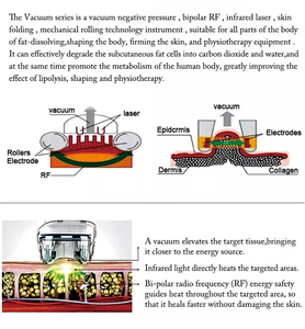 Offre Spéciale : Appareil de remodelage corporel sportif Vera Slim, Machine de remodelage corporel multifonctionnelle portable Vera Roller Big Vacuum Endolifting ABS - Product Image 5