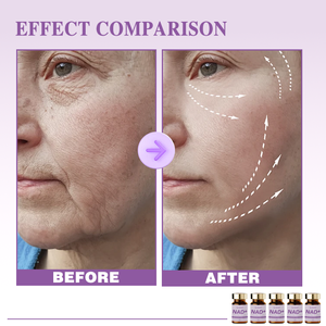 Y Factory Customized NAD+ Skin Booster 5ml*5 Ampoule Revitalize Repair Radiance Serum OEM ODM Private Label Anti-Aging Booster - Product Image 6