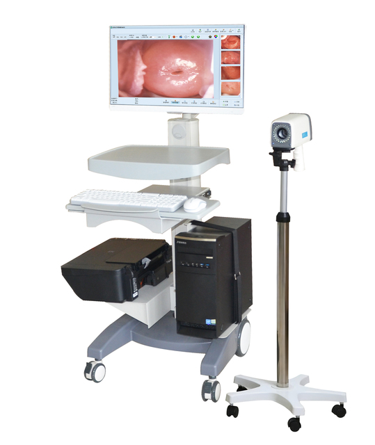 Medical Endoscope Vaginal Colposcopy Digital Imagine Portable Trolley Colposcope/Gynecozlogy Optical Colposcope
