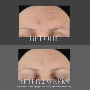 Sérum de traitement raffermissant et adoucissant pour le visage, raffermissant, éclat de la <span class=keywords><strong>peau</strong></span>, réduction des lignes et des rides, sérum de soins corporels - Product Image 3