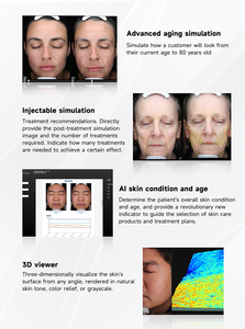 AI Diagnostics Escáner de piel 3D Probador facial Analizador de piel para estética - Product Image 6