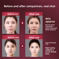 Appareil de massage facial pour le lifting et le raffermissement du double menton en V pour hommes et femmes (Modèle BYM-903S)