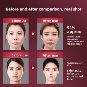 อุปกรณ์นวดหน้า V-Face ยกกระชับและปรับรูปหน้า สำหรับผู้ชายและผู้หญิง (รุ่น BYM-903S) - Product Image 4