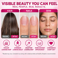 Gummies de biotine, collagène et kératine en gros OEM/ODM 5000mcg 60 unités saveur fraise pour la beauté des cheveux, des ongles et de la peau, sans OGM, sans gluten