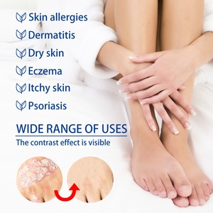 ครีมสมุนไพรเซาท์มูน 20 กรัม สำหรับโรคสะเก็ดเงิน <span class=keywords><strong>สิว</strong></span> ผิวหนังอักเสบ ผื่นคันบริเวณอวัยวะเพศชาย โรคผื่นแพ้ โรคผื่นลมพิษ ได้รับ<span class=keywords><strong>การ</strong></span>รับรองสำหรับโรคผื่นแพ้อวัยวะเพศชาย - Product Image 5