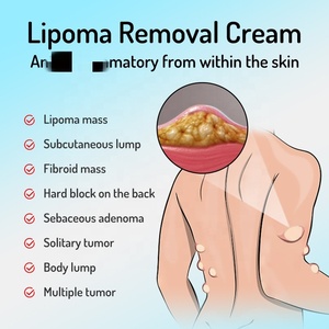 Crème pour l'élimination des lipomes 20g - Formule naturelle à base de plantes pour la lipolyse, l'élimination des amas graisseux - Product Image 3