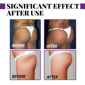 Spot Hip Curve Massage <span class=keywords><strong>olio</strong></span> essenziale idratante e rassodante Hip Scalping Honey Peach Hip - Product Image 2