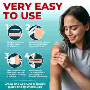 เทปรอย<span class=keywords><strong>แผล</strong></span>เป็นซิลิโคนเกรดทางการแพทย์ที่มองเห็นความแตกต่างที่มองเห็นได้บนแผ่น<span class=keywords><strong>แผล</strong></span>เป็นซิลิโคนแบบใช้ซ้ำได้-ใช้งานง่าย - Product Image 4