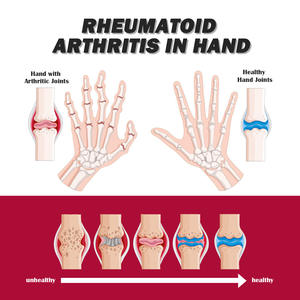 Crema OEM South Moon Nanyue para tratamiento de articulaciones y músculos férula tibial alivia el dolor en manos, pies y pies loción detrás del cuello - Product Image 6