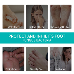 B.I.R.D OEM Customized <strong>Antifungal</strong> Foot <strong>Cream</strong> with Plant Extract for Infection Relief Dry Cracked Skin Repair Inhibit Bacteria - Product Image 3
