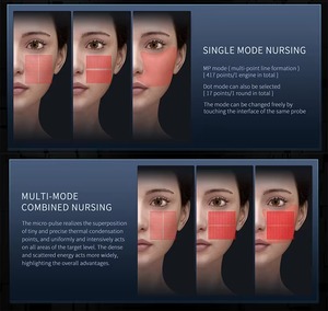 Precio de Promoción: Máquina HIFU 12D para Cuidado Facial y Corporal, Ultrasonido para Eliminación de Arrugas, Lifting Facial y Pérdida de Grasa - Product Image 5