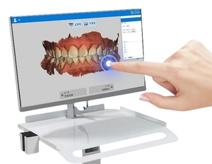 Instrument d'observation intra-dentaire numérique électrique de haute qualité, classe II, certifié CE, en plastique et métal, vente en gros pour dentistes - Product Image 2