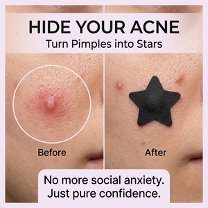 Parche para el Acné StarCare, Parche Hidrocoloide con Diseño de Estrella para una Curación Rápida, Diseño Invisible, Suministro de Fábrica OEM/ODM - Product Image 2