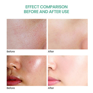 Kit de Soins de la Peau Portable en Forme de Cœur Clover Rena Travel, Ensemble de Capsules Anti-Âge et Blanchissantes Jour & Nuit, 7 pièces, Vitamine C et <span class=keywords><strong>E</strong></span> pour le Visage - Product Image 5