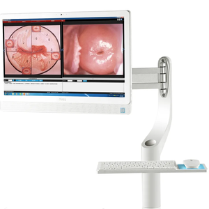 Système d'imagerie de colposcopie vidéo numérique KN-2200BII, colposcope optique binoculaire médical tout-en-un avancé sur chariot - Product Image 3