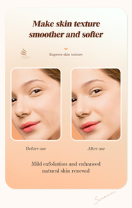 Suero Facial y Corporal de Ácido Hialurónico Orgánico de 110 ml, Más Vendido, Blanqueador, Antienvejecimiento, Hidratante, con Colágeno y Cúrcuma - Product Image 4