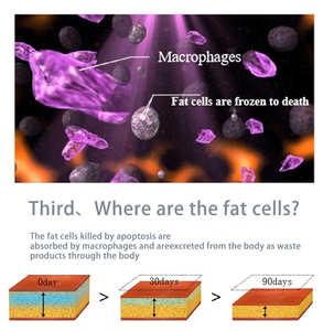 เครื่องสลายไขมันแบบสองหัวจับ รุ่นปี 2026 - Product Image 3