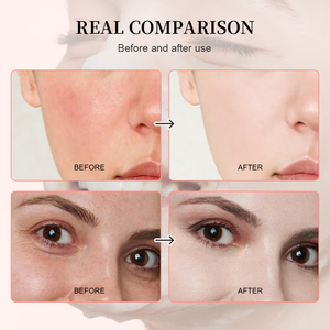 Jabón Exfoliante Artesanal de Flor de Cerezo Orgánico, Antiacné, Iluminador, Servicio ODM/OEM, Se Aceptan Pedidos Pequeños, Personalizado - Product Image 5