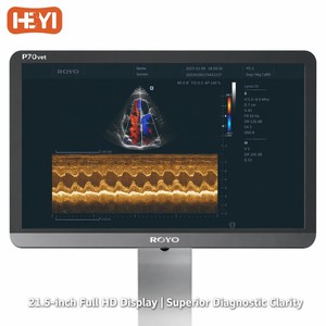 Sistema de Diagnóstico por Ultrasonido Veterinario Profesional Clase II para Clínicas de Gatos HEYI P70vet, Sonda Microconvexa Doppler a Color de Alta Gama - Product Image 3