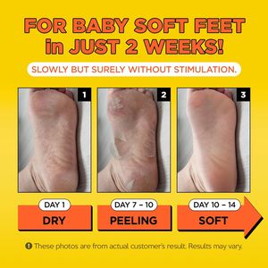 Masque de peau de <span class=keywords><strong>pied</strong></span> de citron de marque privée absorbant rapidement naturel élimine les odeurs masque de pieds doux exfoliant de bébé pour la peau sèche rugueuse - Product Image 4