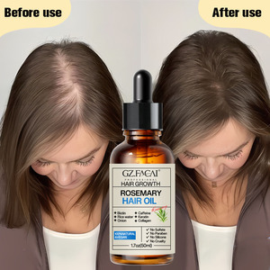 Set Personalizzato di <span class=keywords><strong>Shampoo</strong></span> e Balsamo con Estratti di Rosmarino, Idratante, Nutriente, Stimolante della Crescita dei Capelli - Product Image 6