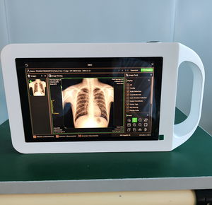 เครื่องเอ็กซ์เรย์แบบพกพา 800 วัตต์ รุ่นใหม่ สำหรับคน สัตว์ และสัตวแพทย์ ระบบดิจิตอล DR - Product Image 5