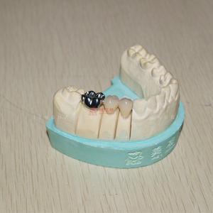 Prezioso e <span class=keywords><strong>Non</strong></span> prezioso metallo dentale Co-Cr lega corona e ponte in alta qualità e buona estetica dentiera denti - Product Image 5