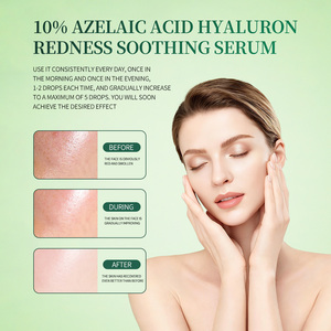 Suero Facial Calmante con Ácido <span class=keywords><strong>Azelaico</strong></span> Coreano 10 <span class=keywords><strong>y</strong></span> Ácido Hialurónico para Piel Sensible, Suero Hidratante Calmante OEM ODM - Product Image 2