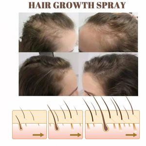 OEM West <span class=keywords><strong>Month</strong></span> <span class=keywords><strong>Hair</strong></span> Root <span class=keywords><strong>Growth</strong></span> Anti Dropping Masaje de cabello firme Tratamientos de crecimiento de cabello denso del cuero cabelludo - Product Image 4