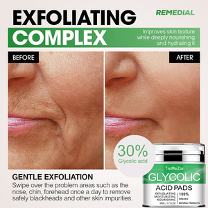 Ensemble de soins de la peau anti-protection, <span class=keywords><strong>point</strong></span> <span class=keywords><strong>noir</strong></span>, cicatrice, crème anti-taches, anti-âge - Product Image 3