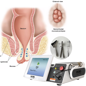 Liposuccion Laser Papada Lipo 980nm et 1470nm lipolyse lifting du visage Endolaser pompe d'élimination des graisses Sculptra BBL laser levage des fesses - Product Image 5