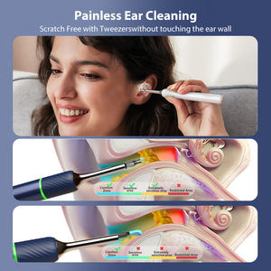 Bebird N5 Pro Mall Trend Electronic Product Pinzas Herramienta de eliminación de cerumen - Product Image 6