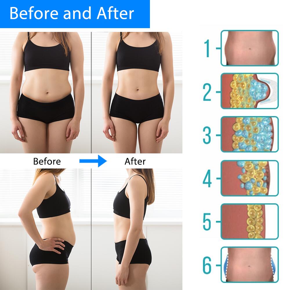 Safe Cryolipolysis Belt Slimming Fat Freezing Machine Cryopad Cooling Weight Loss
