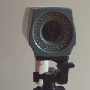 Medische HD Gynaecologie Video Colposcopie Elektronische Video Colposcoop voor Vrouwen Colposcopie voor Gynaecologie - Product Image 2