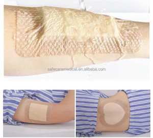 滅菌傷ドレッシングシリコーンフォームドレッシング - Product Image 4