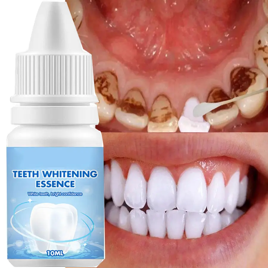 Sbiancamento dei denti siero in polvere igiene orale siero detergente rimuove le macchie di placca sbiancamento dei denti siero dentale