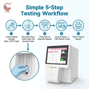 Analizador de Sangre Veterinario Automático de 3 Partes CYB-5200V, Contador de Células Sanguíneas para Animales, Máquina CBC para Hospitales Veterinarios - Product Image 3