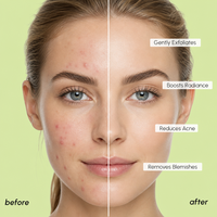 Disques Toniques Exfoliants Nettoyants en Profondeur à l'Acide Salicylique 2%, Centella Asiatica, Niacinamide et Arbre à Thé pour Affiner les Pores - Marque Blanche