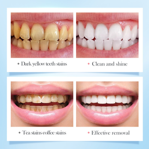 <span class=keywords><strong>Dentifrice</strong></span> blanchissant chimique OEM à la fleur de cerisier 100g pour la maison, élimine les taches de thé et de café, haleine fraîche, blanchiment quotidien des dents, soin buccal - Product Image 3