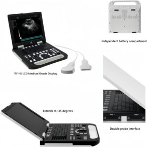 Scanner portatif complet numérique dp10 à ultrasons LED Machine à ultrasons d'application clinique Ruisheng N50 - Product Image 4