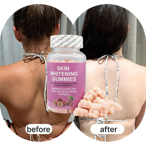 OEM/ODM Premium Skin Whitening Gummies With Glutathione Collagen Biotin for <strong>Hydrated</strong> Youthful Glowing Skin Beauty <strong>Supplement</strong> - Product Image 4