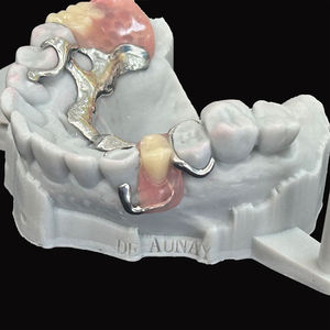 Cadre en alliage Cocr pour prothèses partielles avec base en résine dents acryliques prothèses amovibles en laboratoire dentaire en chine - Product Image 6