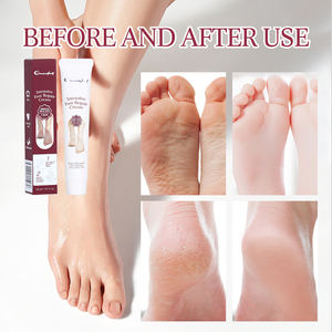 <span class=keywords><strong>Crema</strong></span> Reparadora Intensiva para Pies con Servicio Integral, Exfolia Suavemente para Eliminar la Piel Muerta y las Callosidades, Suaviza y Acondiciona los Pies - Product Image 2