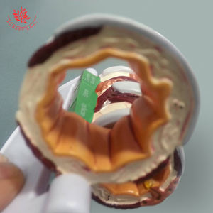 4-delige Brounchus Model Normale Zwelling Hypersecretie Spierspasmen Anatomisch Model - Product Image 6