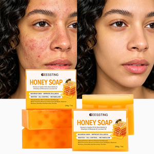 Savon au Miel de Manuka Éclaircissant Rapide en Gros 200g, Fait Main à l'Huile de Coco, Éclaircissant pour Peaux Foncées, Visage et Corps, Savon Solide au Miel - Product Image 1