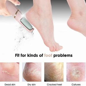 Lime à pieds électrique pour éliminer les peaux mortes, lime à callosités rechargeable, outils de pédicure, kit de soin des pieds - Product Image 5